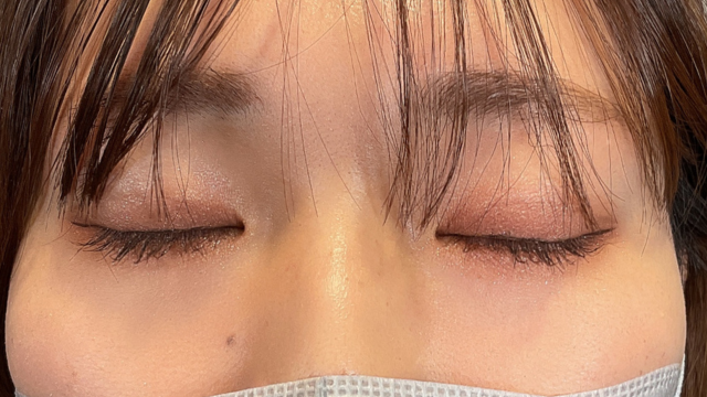 Postoperative Condition Part 1