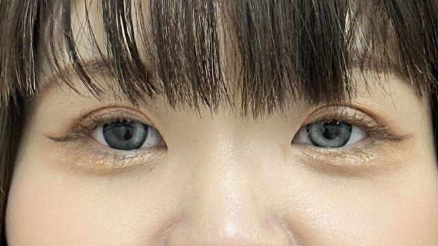 Postoperative Condition Part 1