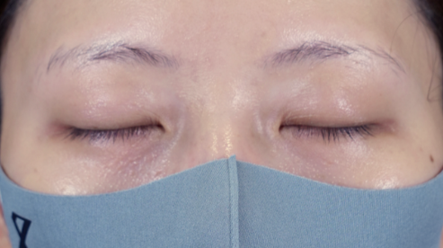 Postoperative Condition Part 1