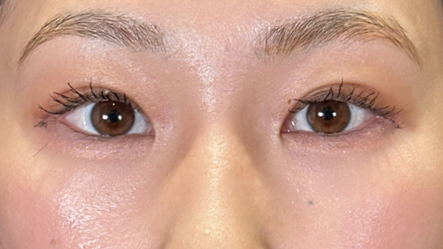 Postoperative Condition Part 1