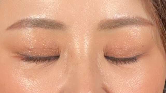 Postoperative Condition Part 1