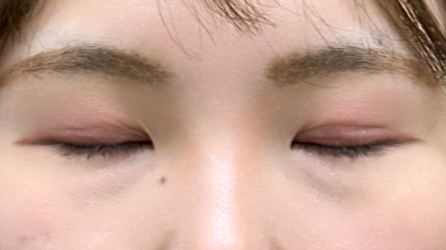 Postoperative Condition Part 1