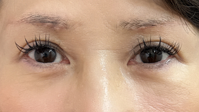 Postoperative Condition Part 1