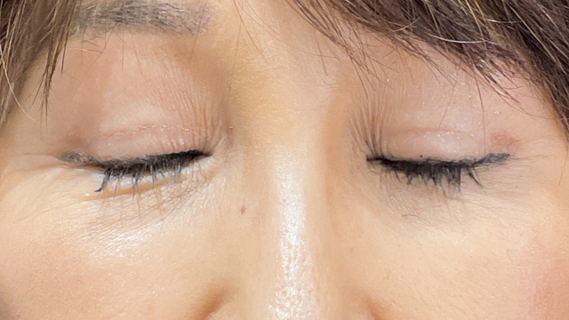 Postoperative Condition Part 1