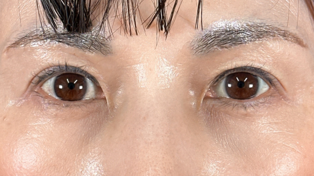 Postoperative Condition Part 1