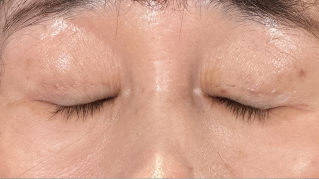 Postoperative Condition Part 1