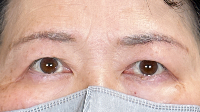 Postoperative Condition Part 1