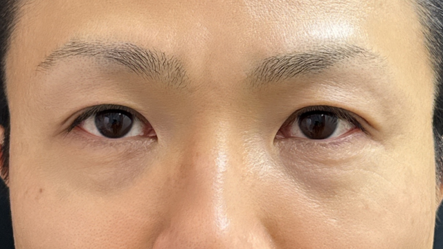 Postoperative Condition Part 1