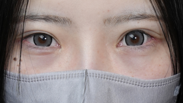 Postoperative Condition Part 1