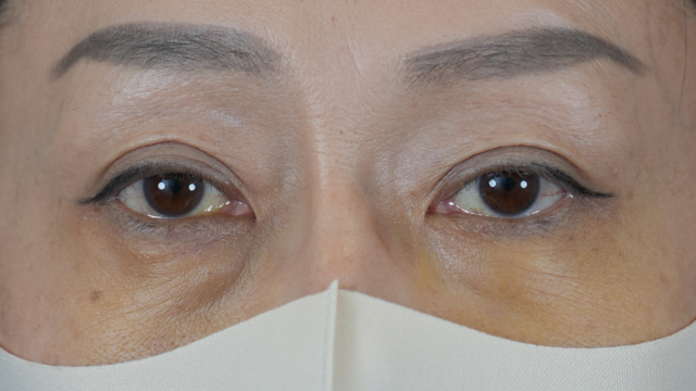 Postoperative Condition Part 1