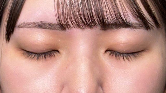 Postoperative Condition Part 1