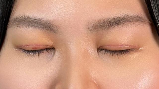 Postoperative Condition Part 1