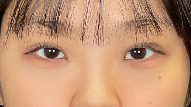 Postoperative Condition Part 1