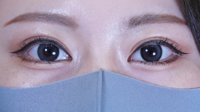 Postoperative Condition Part 1