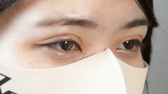 Postoperative Condition Part 1