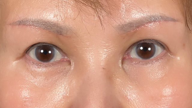 Postoperative Condition Part 1