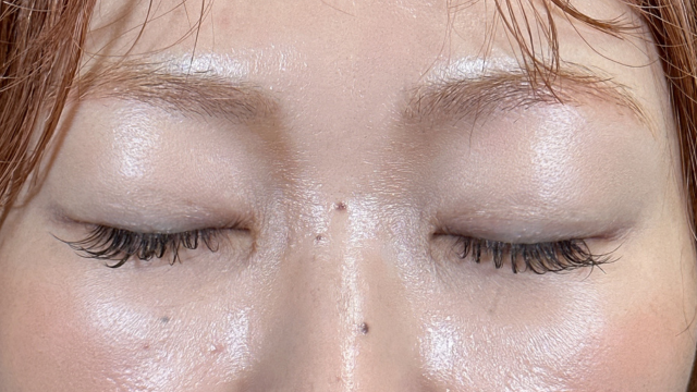 Postoperative Condition Part 1