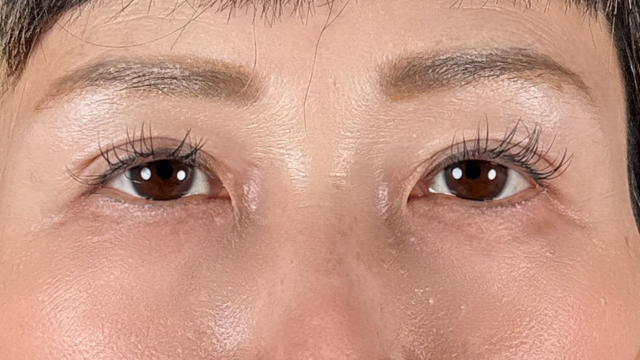 Postoperative Condition Part 1