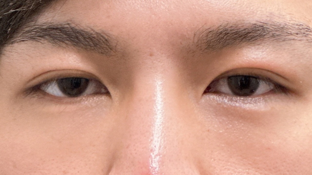 Postoperative Condition Part 1