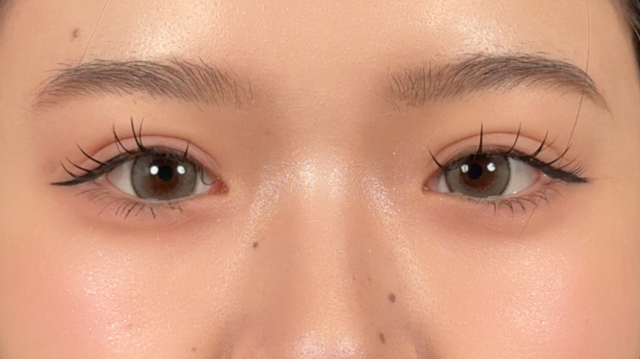 Postoperative Condition Part 1