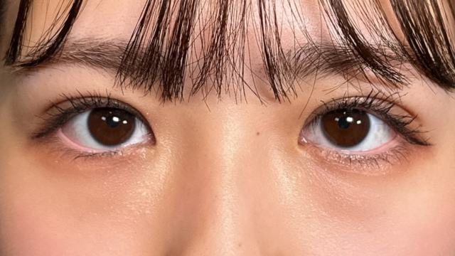 Postoperative Condition Part 1