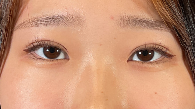 Postoperative Condition Part 1