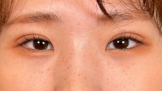 Postoperative Condition Part 1