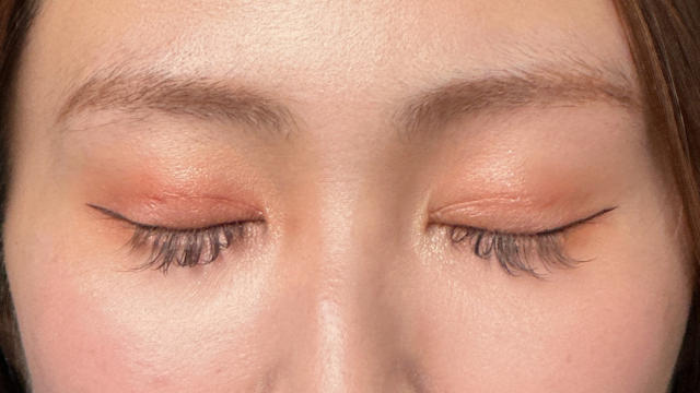 Postoperative Condition Part 1