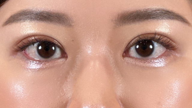 Postoperative Condition Part 1