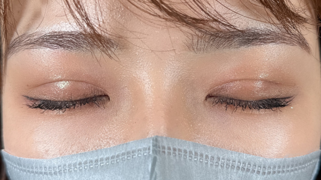 Postoperative Condition Part 1