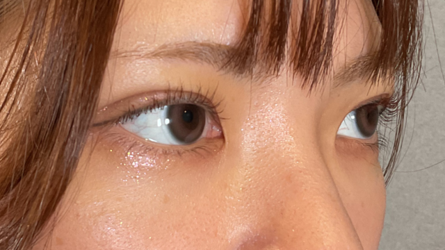 Postoperative Condition Part 1