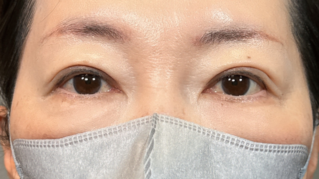 Postoperative Condition Part 1