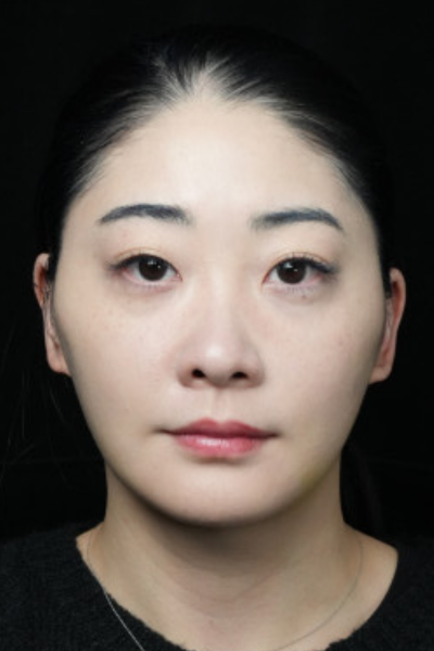 手術前の状態 その1