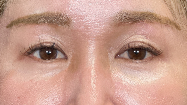 Postoperative Condition Part 1