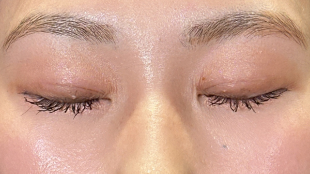 Postoperative Condition Part 1