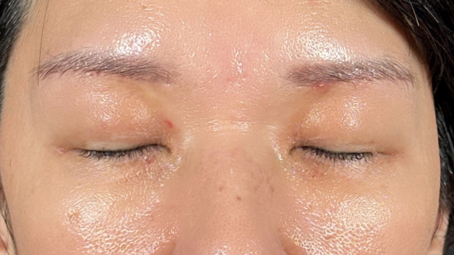 Postoperative Condition Part 1