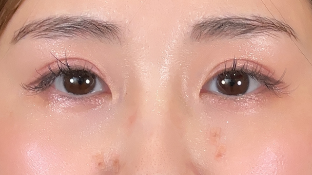 Postoperative Condition Part 1