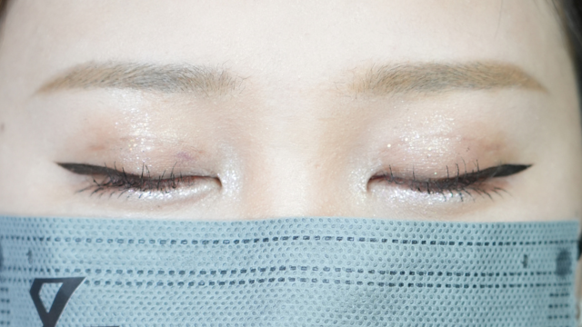 Postoperative Condition Part 1