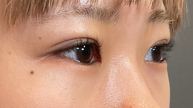 Postoperative Condition Part 1