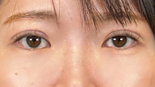 Postoperative Condition Part 1