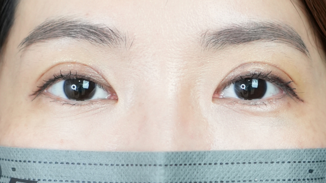 Postoperative Condition Part 1