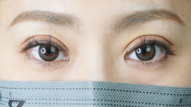 Postoperative Condition Part 1