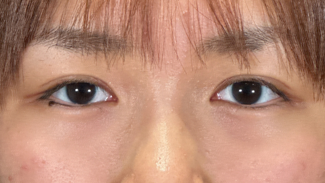 Postoperative Condition Part 1