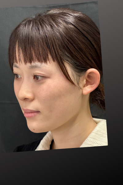 Postoperative Condition Part 1