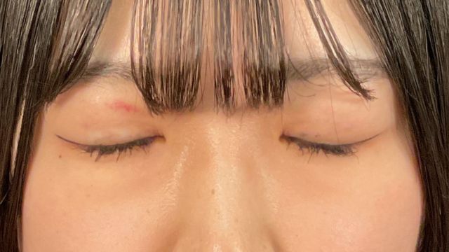 Postoperative Condition Part 1