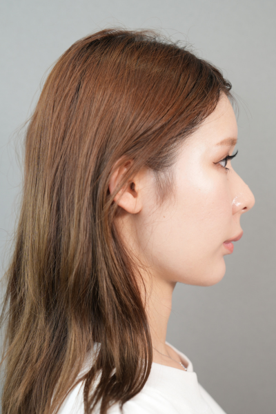 Postoperative Condition Part 1