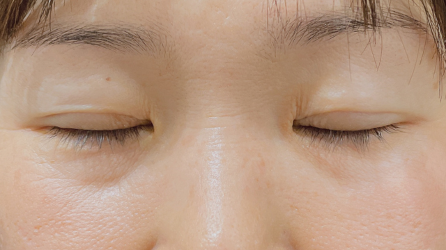 Postoperative Condition Part 1