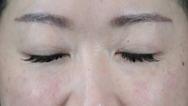 Postoperative Condition Part 1