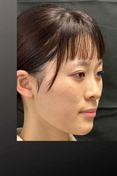 Postoperative Condition Part 1