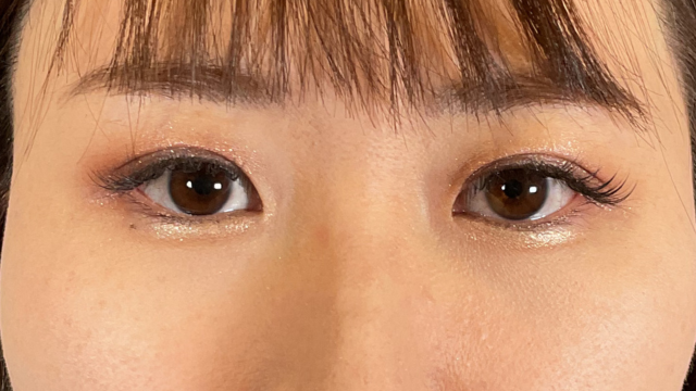 Postoperative Condition Part 1